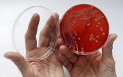 Opracowano nowe sposoby walki z bakteriami odpornymi na antybiotyki